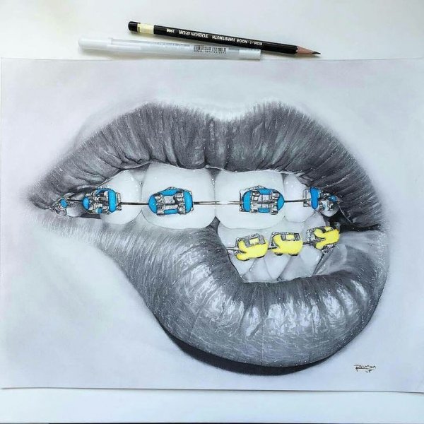 Губы с брекетами рисунок