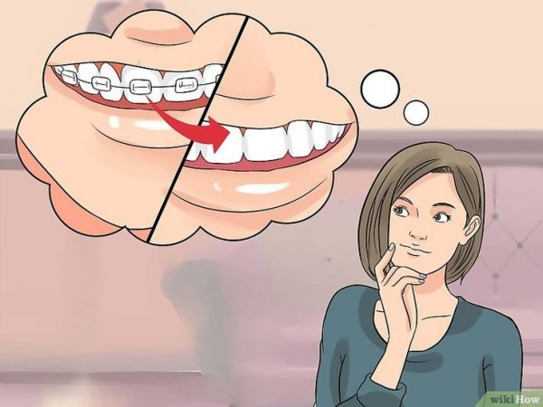 Прикольные картинки с брекетами