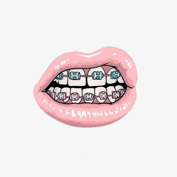 Брекеты нарисованные