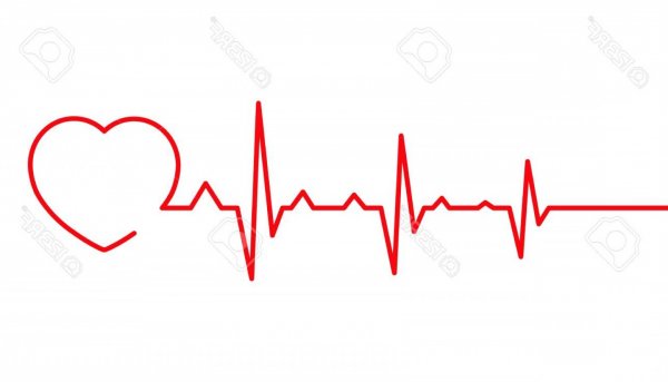 Сердцебиение в виде сердечка