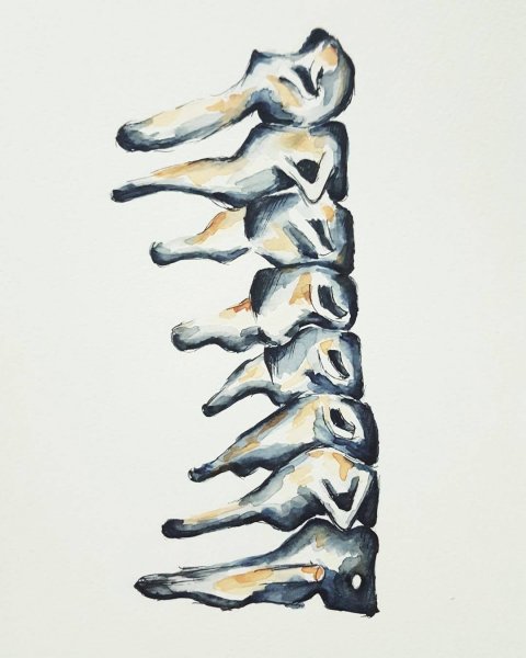 Металлический позвоночник