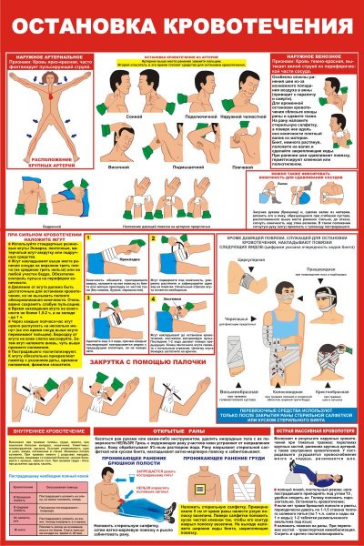 Остановка кровотечения плакат