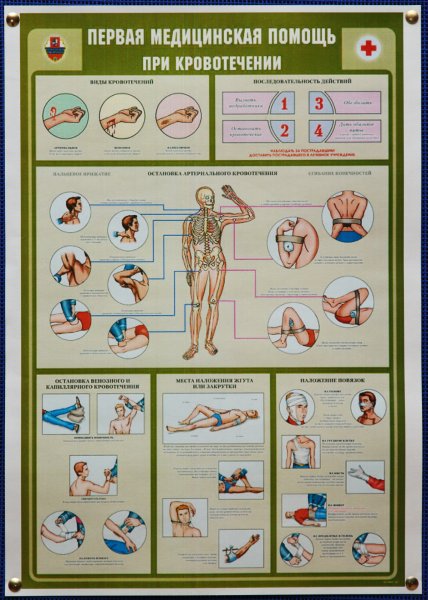 Памятка по оказанию ПМП при кровотечениях