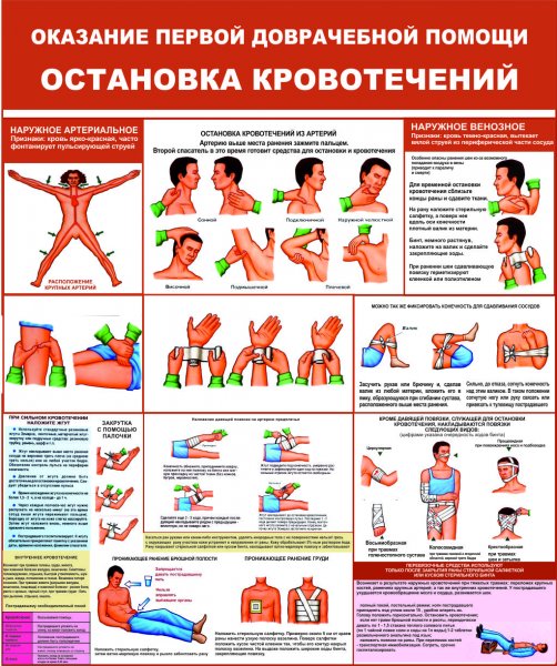 Остановка кровотичени