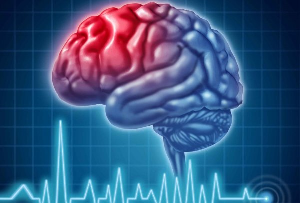 Всемирный день мозга (World Brain Day)