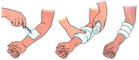 Как нарисовать рану (62 фото)