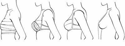 Грудь 3 вид сбоку