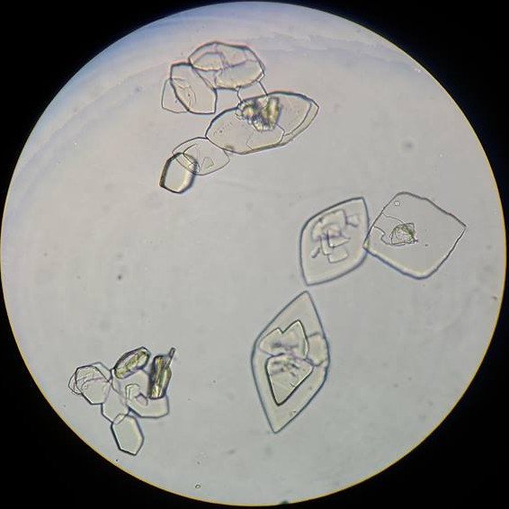 Оксалат кальция Рафиды Кристаллы друзы