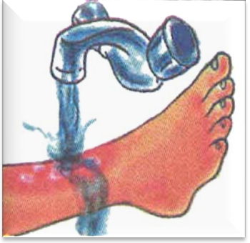 Оказание первой помощи при ожогах электрическим током