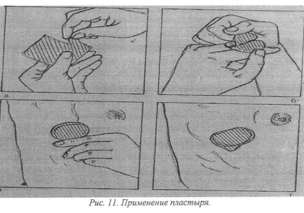 Пластырь использование