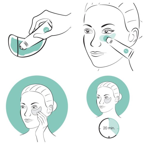 Схема наложения патчей