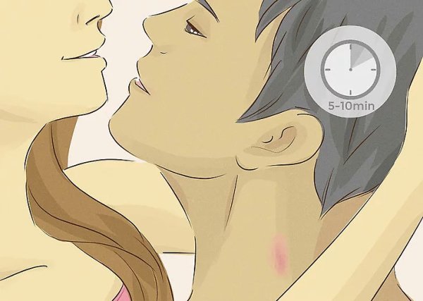 Ларри Стайлинсон арты 18