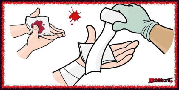 Накладывание жгута при артериальном кровотечении