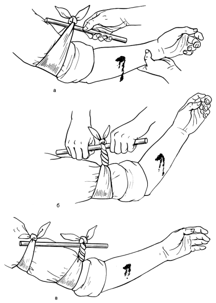 Обработка РАН первая помощь
