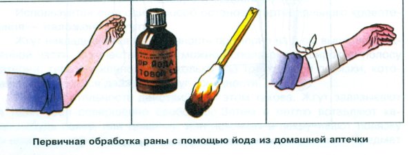 Наложение восьмиобразной повязки на кисть