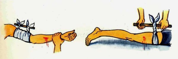 Рубленая рана изображение