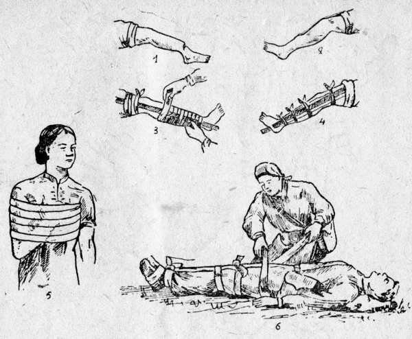 Проведение перевязки гнойной раны