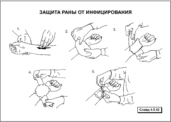 Наложение повязок при травмах