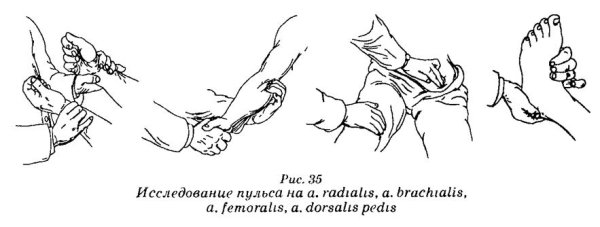 Пальпаторное исследование артериального пульса