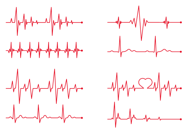 ЭКГ на белом фоне