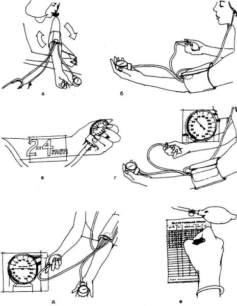 Измерение давления тонометром алгоритм