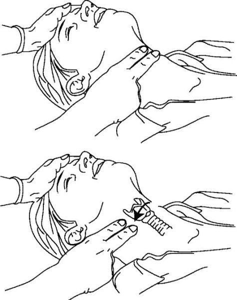 Измерение пульса на сонной артерии