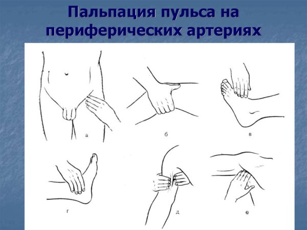 Пальпаторный метод измерения пульса