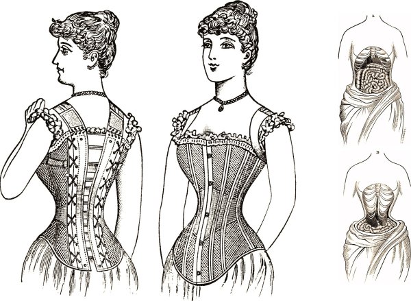 Корсеты для беременных 19 век