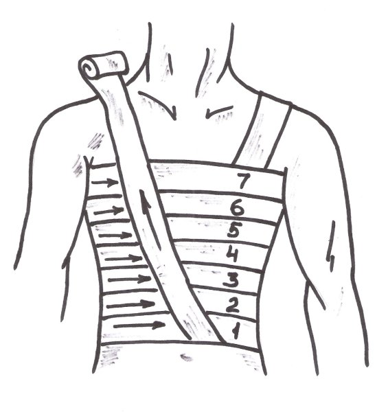 Десмургия спиральная повязка на грудную клетку