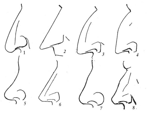 Типы Носов курносый
