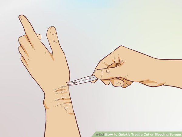 Суицидальные зарисовки