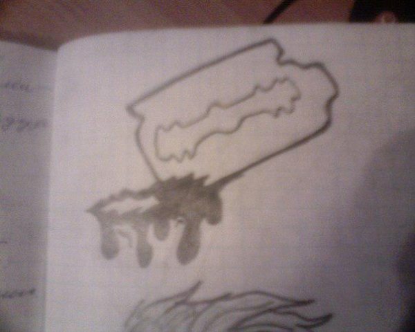 Острая кровопотеря рисунок