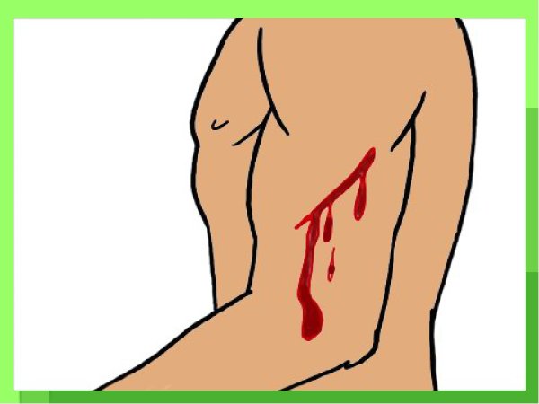 Рисунки карандашом порезы