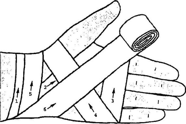 Остановка капиллярного кровотечения алгоритм