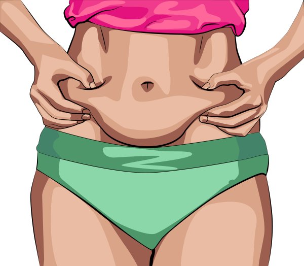 Техника туалета пупочной ранки у новорожденного.