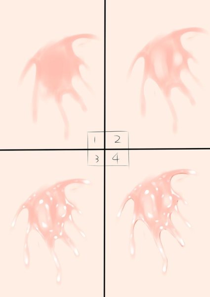 При термических ожогах необходимо