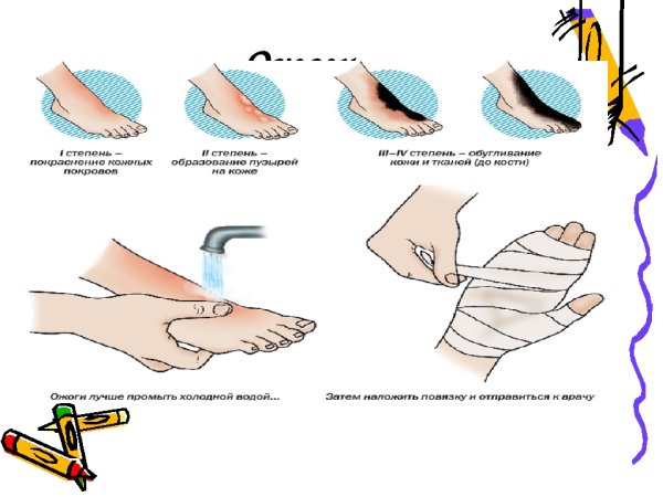 Туториал огонь карандашом