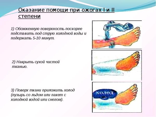 Химический ожог рисунок