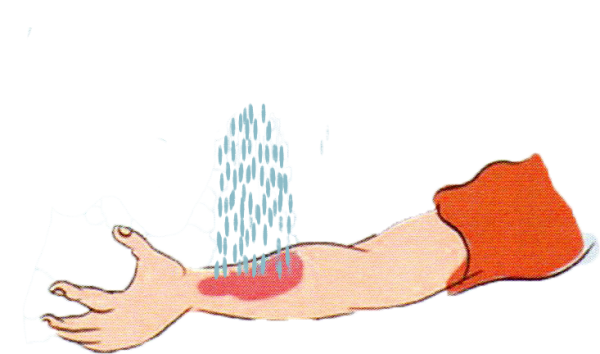 Оказание первой медицинской помощи для дошкольников
