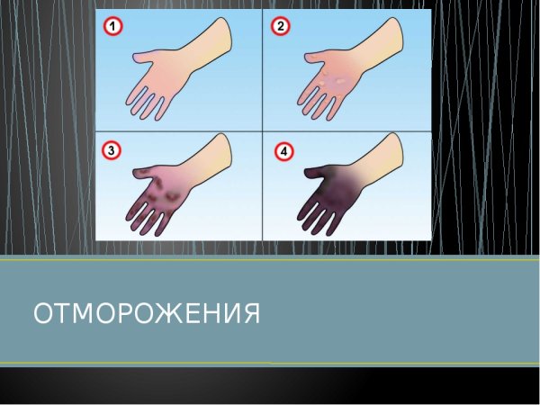 Мальчик поранился