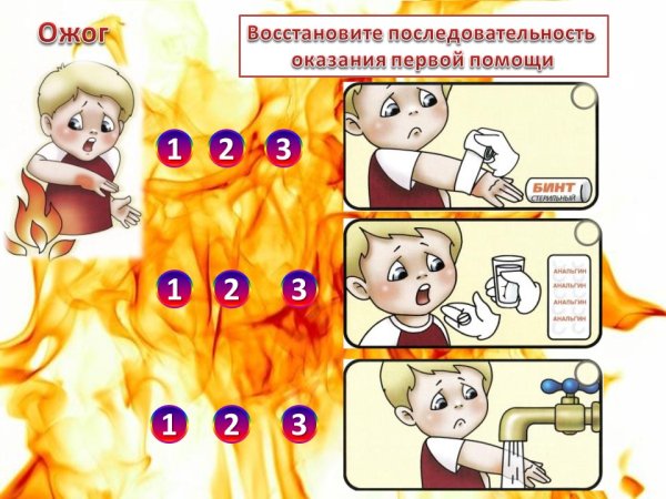 Холодная вода при ожоге