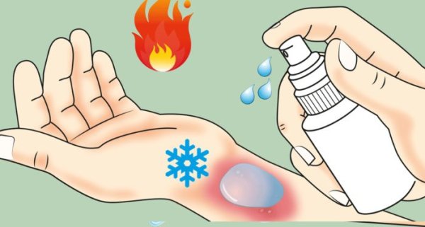 Первая помощь при ожогах для детей