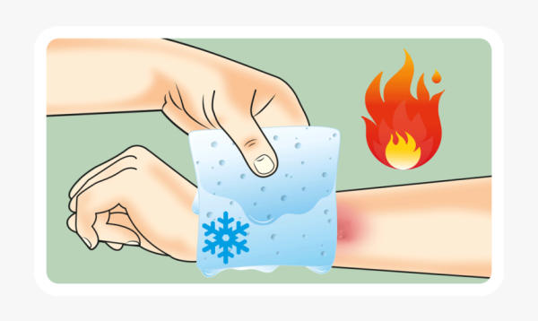 Термические ожоги презентация