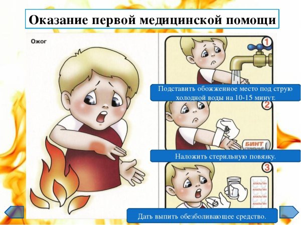 Оказание 1 помощи пострадавшим при ожогах
