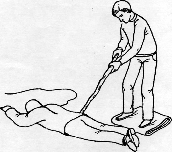 Памятка при порезах и ожогах