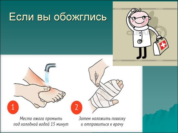 Ожог презентация 1 класс