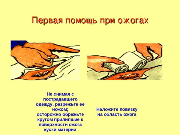 Местное охлаждение при травмах, термических ожогах