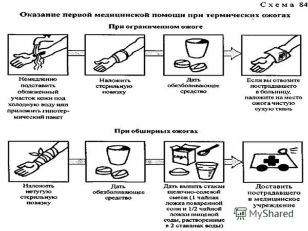 Ожог раскраска для детей