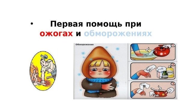 Профилактика от ожогов памятка