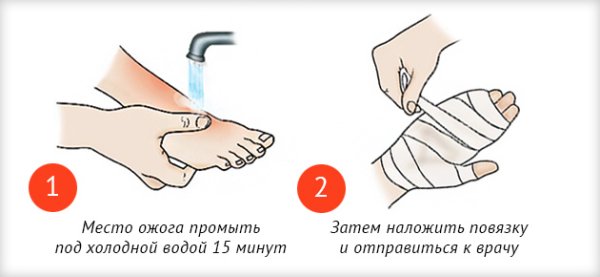 Четвертая степень ожогов